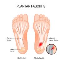 Foot Pain Therapy image 7